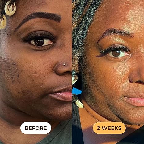 Turmeric Dark Spot Removal Scrub