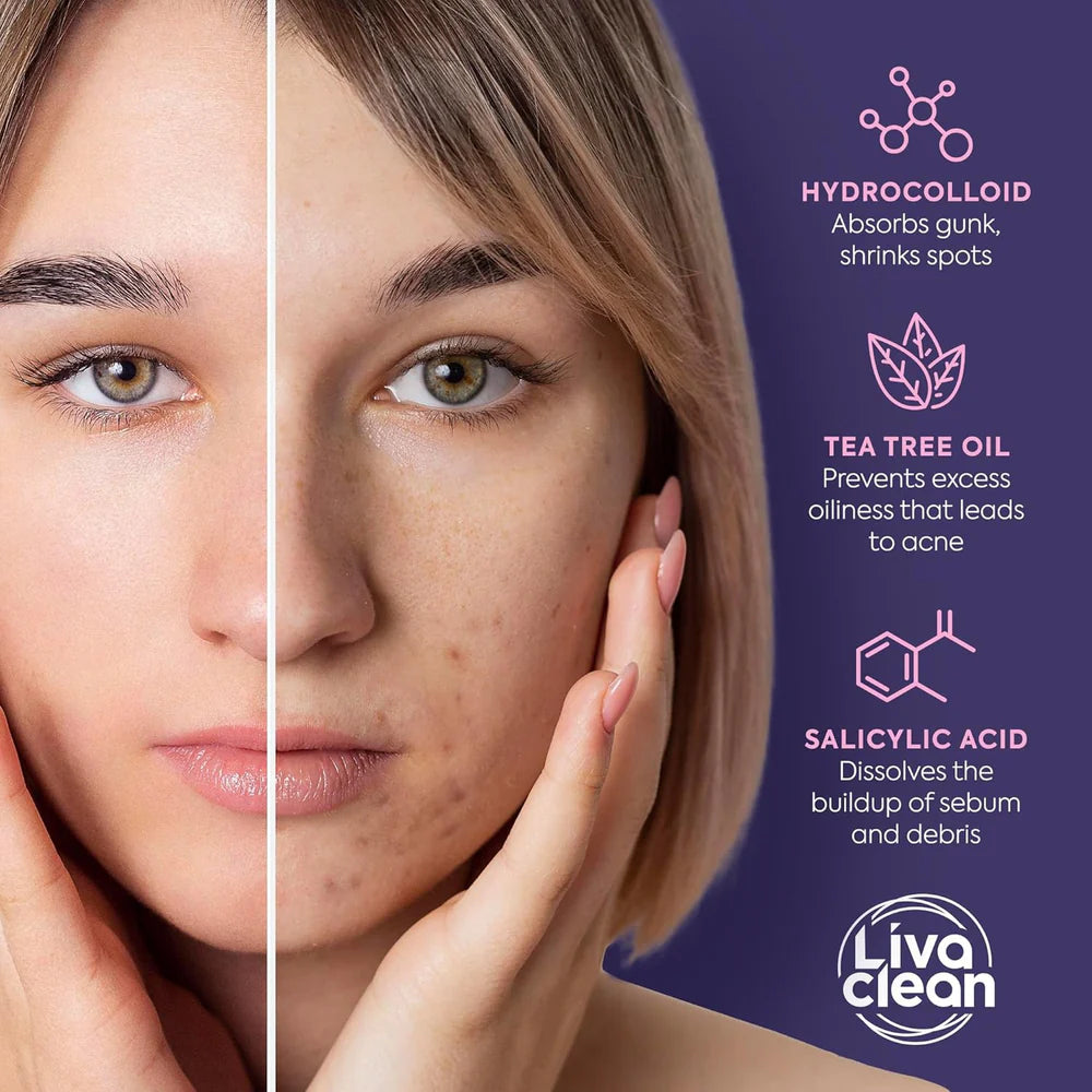 Acne Pimple Patches 5 Color Star Shaped