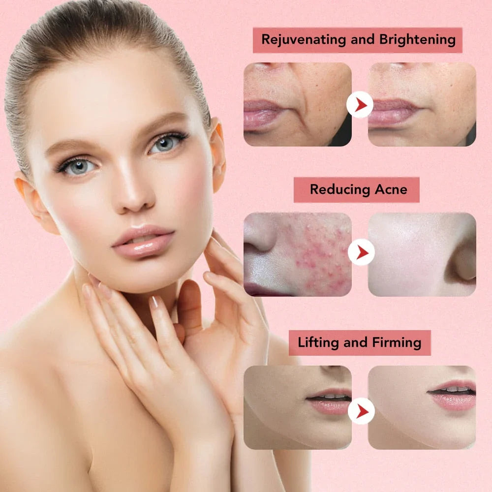 Face Lift Device Facial Massager