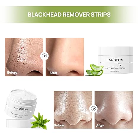 Neliora Blackhead Removal Strips