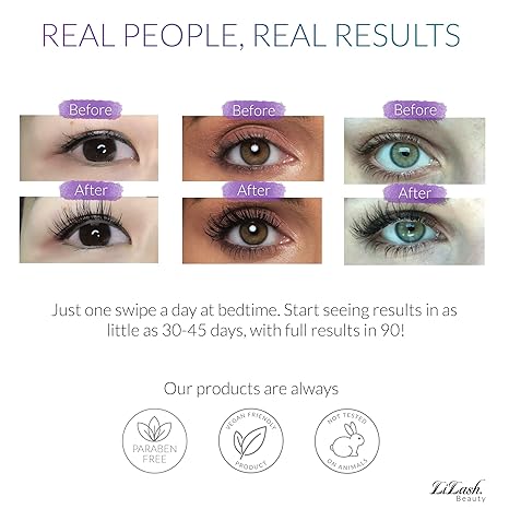 Fast Growth Eyelash Serum
