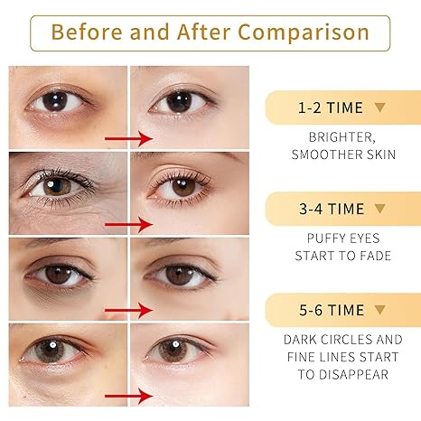 Aureus Golden Eye Patch: Rejuvenating Under-Eye Mask Solution