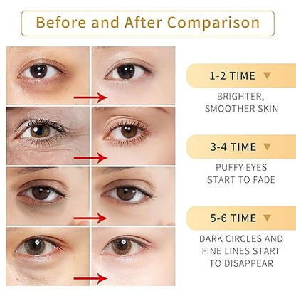 Aureus Golden Eye Patch: Rejuvenating Under-Eye Mask Solution