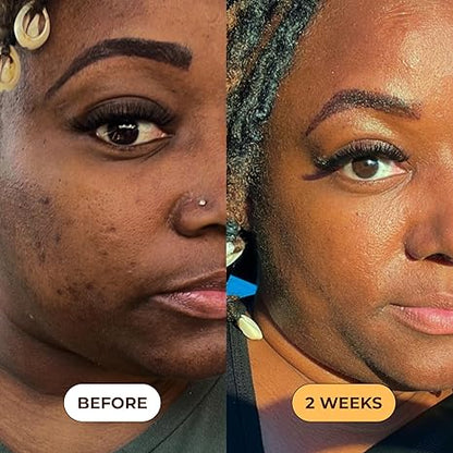 Turmeric Dark Spot Removal Scrub